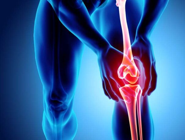 Co powoduje ból kolana?